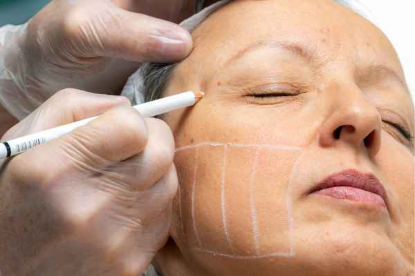 CryoPen: 5 Skin Concerns It May Be Used to Treat 4 What should you ask before having CryoPen treatment Brent?