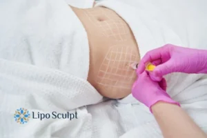 Are The Results From Aqualyx Permanent? 1 Do you want to know how long Aqualyx Brent results last?