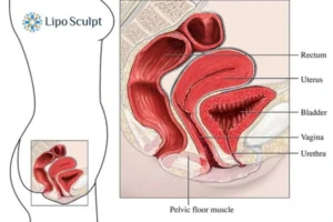 Treatment For A Leaky Bladder 2 How EM Chair treatment Brent can help Leaky bladder issues. Read more now!