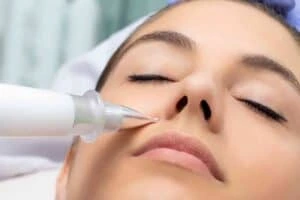 Best Actinic Keratoses Removal 3 Actinic keratoses Brent solutions - book in today!