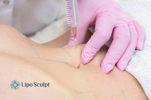 Aqualyx for Muffin Tops: What to Know Before Fat-Dissolving Injections 4 Are there risks Brent?